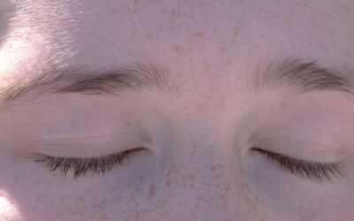 IPL vs Lipiflow: Which Dry Eye Treatment Is Right for You?