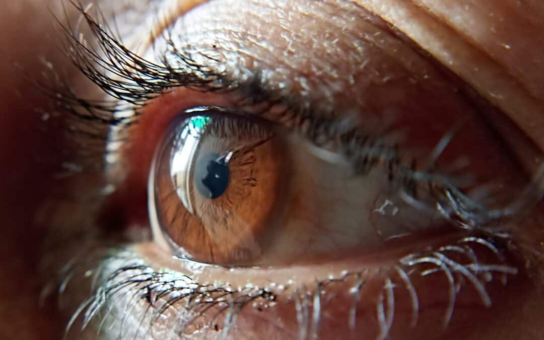 Understanding Retinal Tears and Detachments: Early Warning Signs You Shouldn’t Ignore