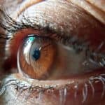 Photo Retinal Tears and Detachments